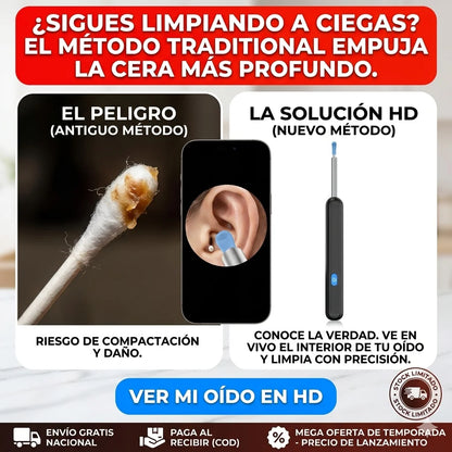 Limpia Oidos Extractor Cera camara